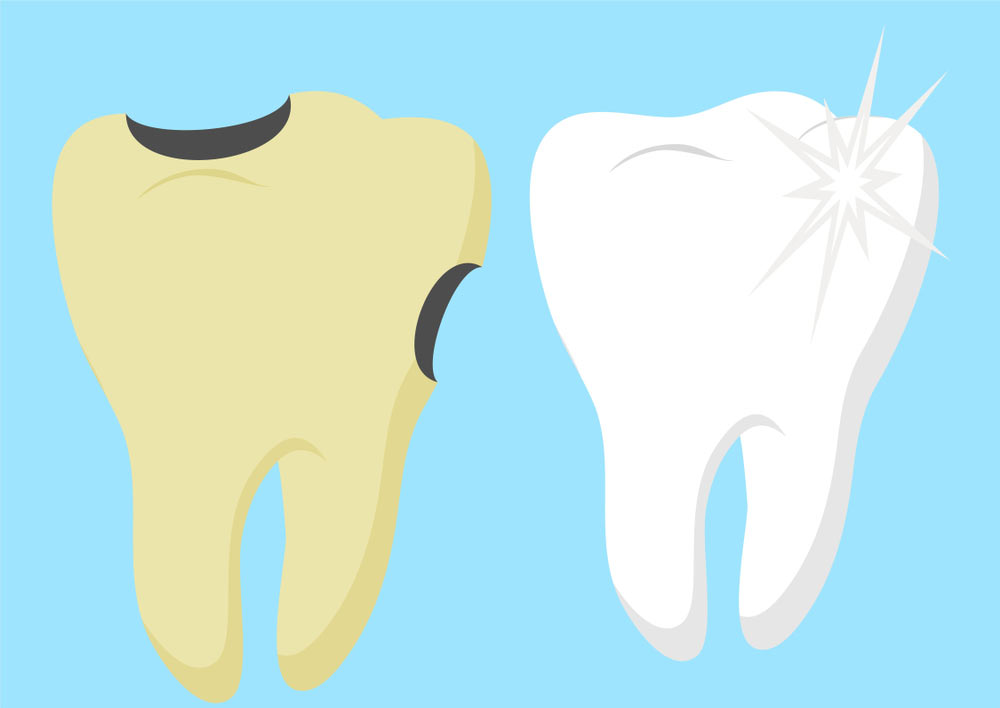 Dental checkup