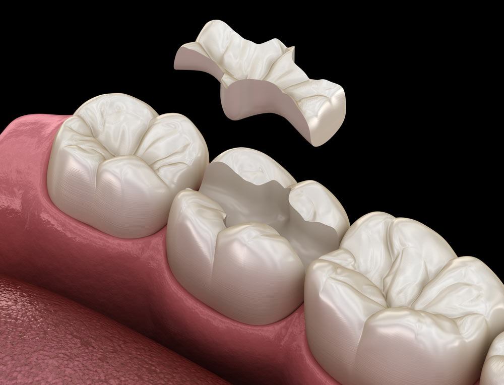 Dental checkup
