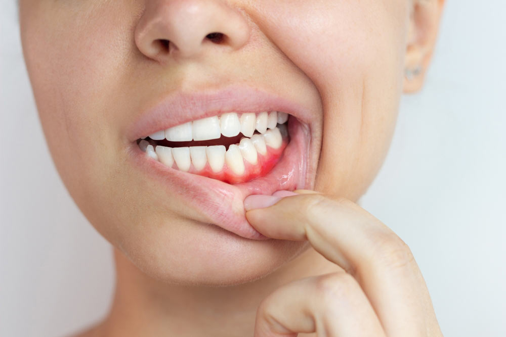 Dental checkup