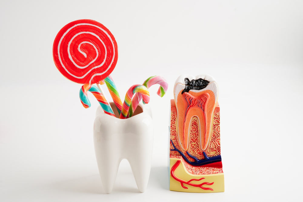 Sugar causes cavities
