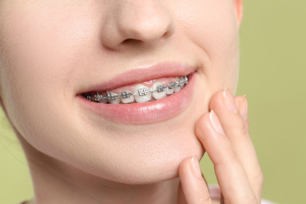 Brushing teeth with braces