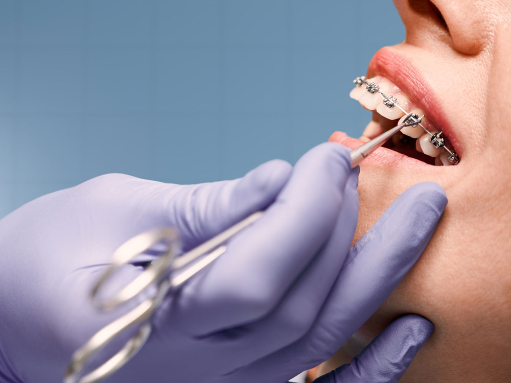 Teen orthodontist visit
