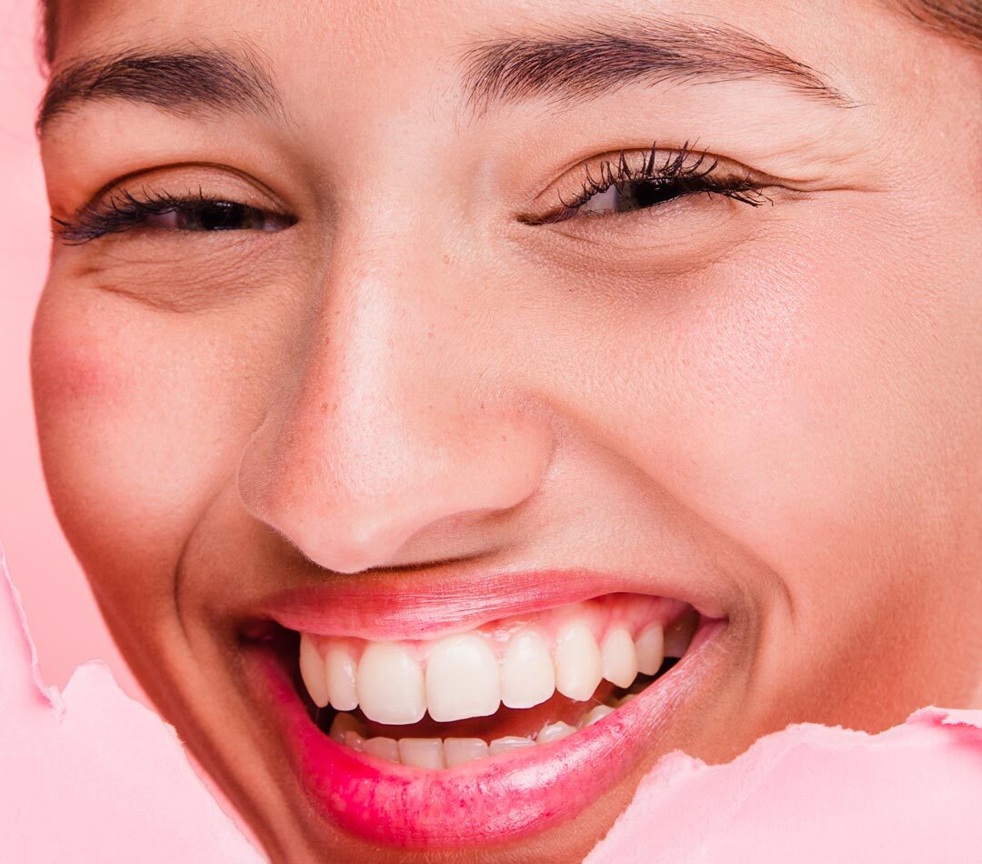 What is KoR Teeth Whitening
